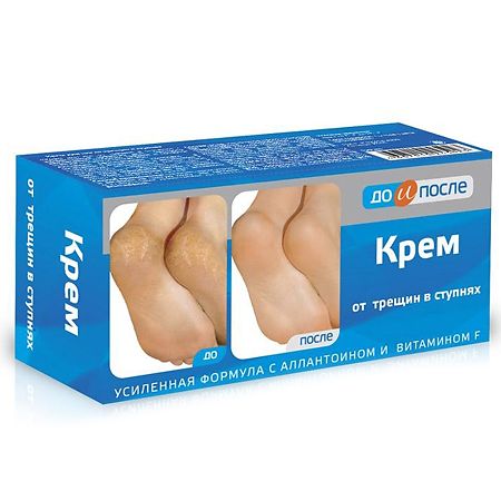 Изображение товара До и После Крем от трещин стоп 150 мл 1 шт
