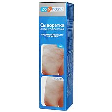 Купить До и После Сыворотка Антицеллюлитная 130 мл 1 шт цена
