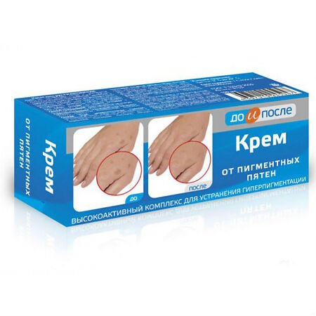 Изображение товара До и После Крем от пигментных пятен 50 мл 1 шт