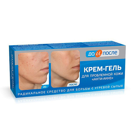 Изображение товара До и После Крем-гель анти-акне для проблем кожи 50 мл 1 шт