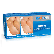 Изображение товара До и После Крем от трещин в ступнях 50 мл 1 шт