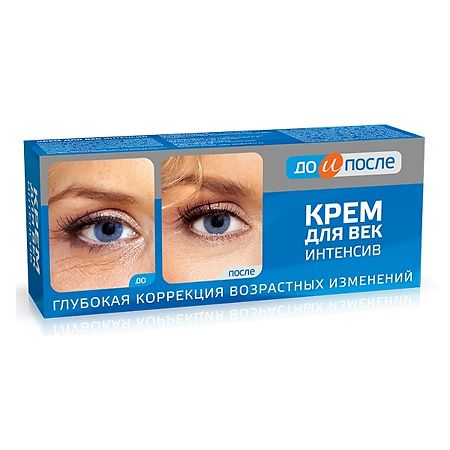 Изображение товара До и После Крем интенсив для век 30 мл 1 шт