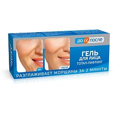 Изображение товара До и После Тотал-лифтинг гель для лица 50 мл 1 шт