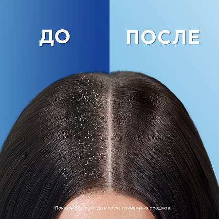 Шампунь Head & Shoulders 2в1 п/перхоти Основной уход для нормальных волос, 400 мл 1 шт