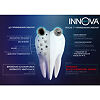 Innova Sensitive Зубная паста Бережное осветление эмали 75 мл 1 шт