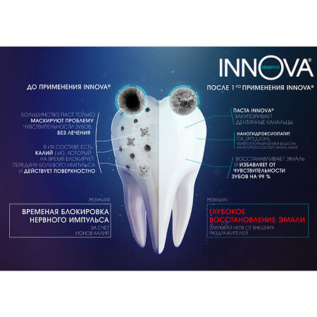 Innova Sensitive Зубная паста Бережное осветление эмали 75 мл 1 шт