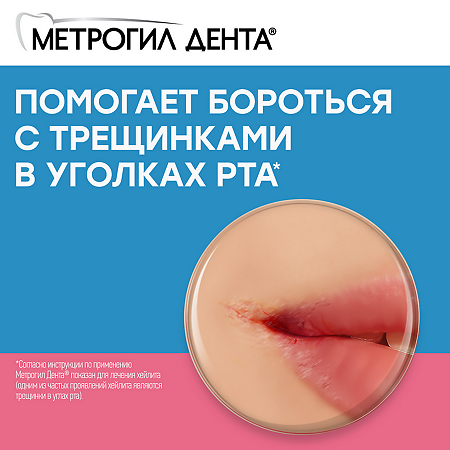 Метрогил Дента гель стоматологический 20 г 1 шт