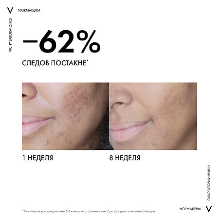 Vichy Normaderm Крем для проблемной кожи склонной к жирности 50 мл 1 шт