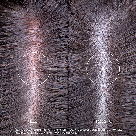 Klorane шампунь с органическим экстрактом Пиона успокаивающий 400 мл 1 шт