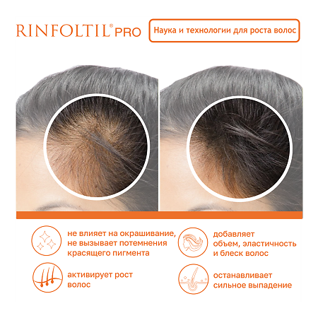 Ринфолтил Про Нанолипосомальная сыворотка против выпадения волос для женщин и мужчин 160 мг фл 30 шт