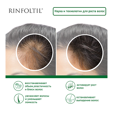 Ринфолтил липосомальная сыворотка для интенсивного роста волос против выпадения и ломкости фл 30 шт