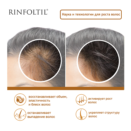 Ринфолтил Липосомальная сыворотка против выпадения волос при любом типе выпадения волос фл 30 шт