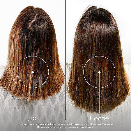 Klorane шампунь с экстрактом Хинина и экстрактом Эдельвейса 400 мл 1 шт