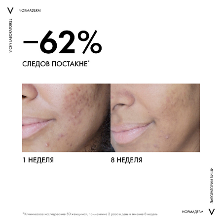 Vichy Normaderm Крем для проблемной кожи склонной к жирности 30 мл 1 шт