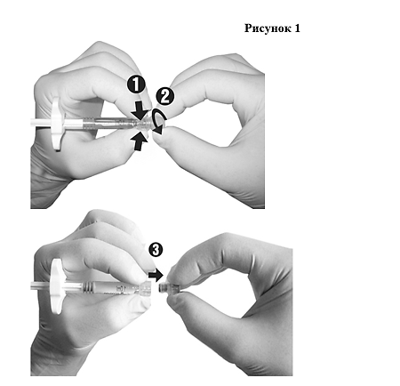 Гиалджект имплантат вязкоэластичный стерильный 1,8% 2 мл шприц 1 шт