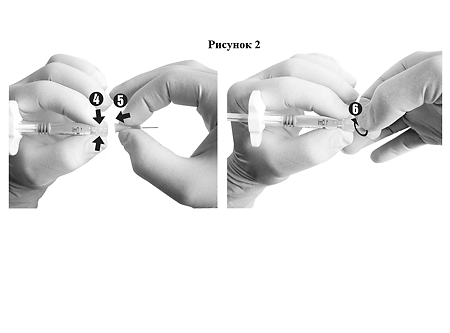 Гиалджект имплантат вязкоэластичный стерильный 1,8% 2 мл шприц 1 шт