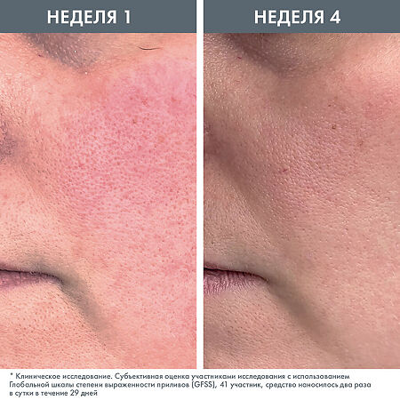 Avene Antirougeurs Rosamed Защитный увлажняющий концентрат для кожи склонной к покраснениям 30 мл 1 шт