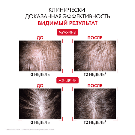 Vichy Dercos Aminexil R.E.G.E.N. Booster Сыворотка для укрепления и роста волос 90 мл 1 шт
