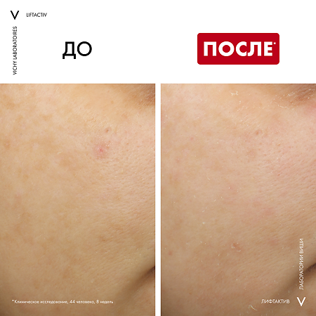 Vichy Liftactiv Ночной Крем Купить