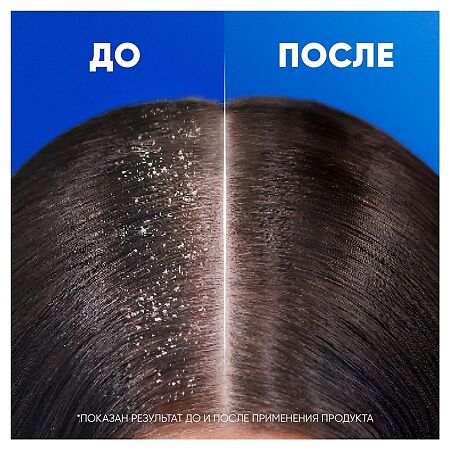 Head & Shoulders Шампунь и бальзам-ополаскиватель от перхоти для волос Основной уход 2в1 800 мл 1 шт